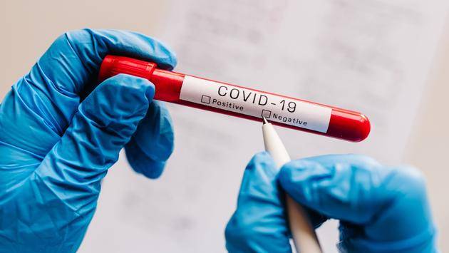 CDC Says No To Required COVID Testing Before Domestic Flights